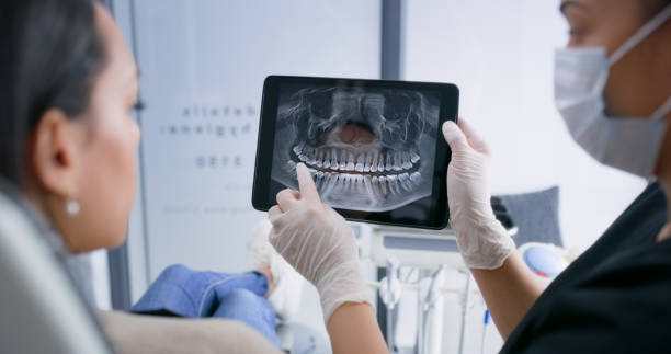 Licensed Root Canal Treatment service in San Luis Obispo County County, CA - Smile Center Dentistry